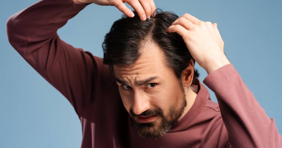 How to Choose the Best Hair Transplant Method