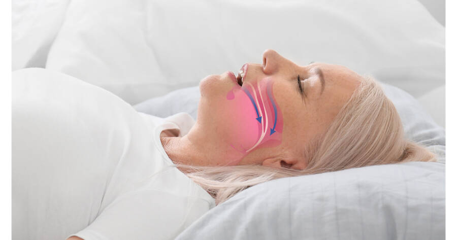How Anti-Snoring Devices May Improve Sleep Quality
